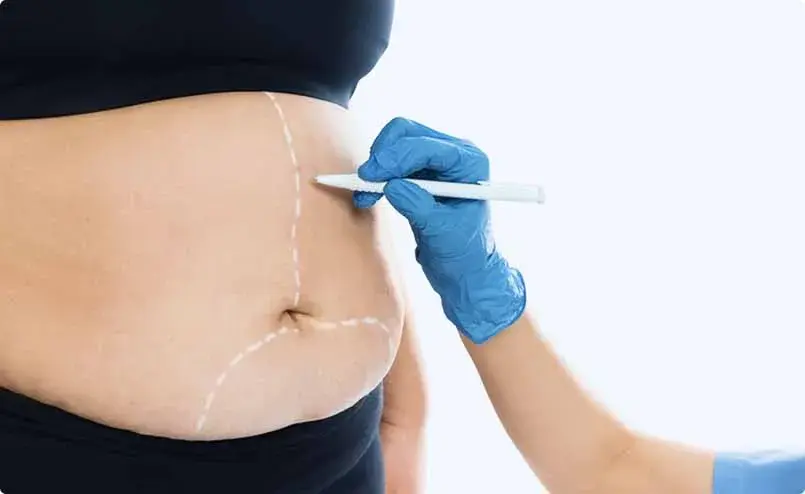 Private Weight Loss Treatment and Bariatric Surgery in Coventry